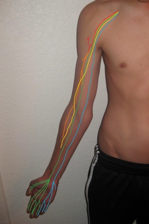 Brachial plexus - Physiopedia muscle diagram project 
