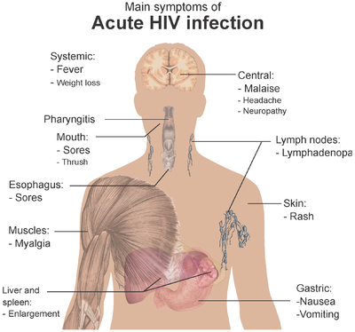hiv disease symptoms