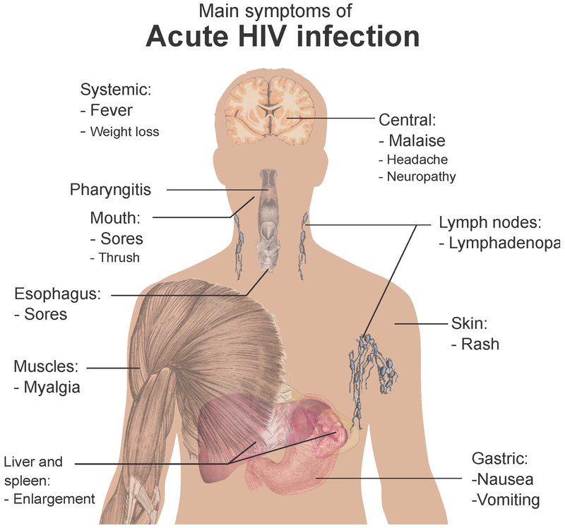 Human Immunodeficiency Virus Hiv Physiopedia 