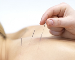 COMBINING TECHNIQUES: GRASTON AND FUNCTIONAL DRY NEEDLING +E-STIM