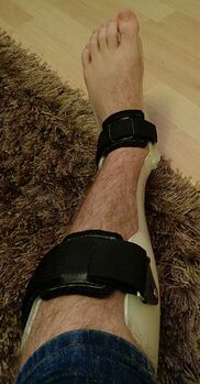 Introduction to Ankle Foot Orthoses - Physiopedia