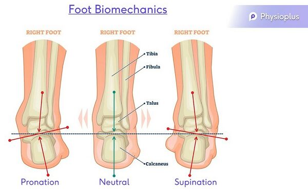 Editing Foot Orthotics Assessment - Physiopedia