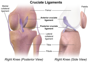 Posterior Cruciate Ligament Injury - What You Need to Know