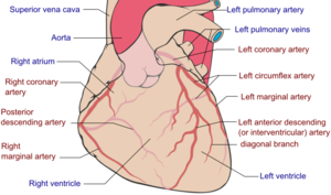 In this example, the right ventricle (RV) is also left sided but
