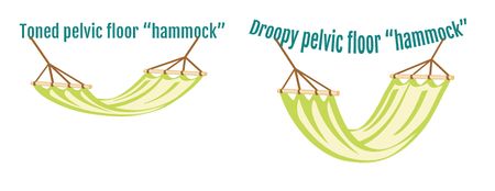 Pelvic-floor-muscles hammock.jpg