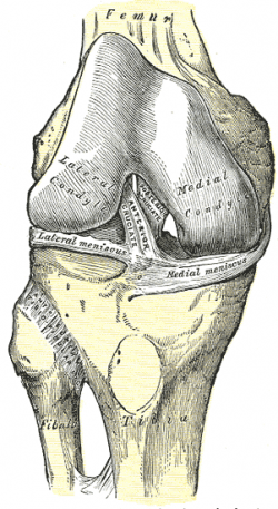 Anterior Cruciate Ligament (ACL) Injuries: What Are They, Female