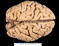 Note the raised sulci and depressed gyri forming the surface of the cerebrum