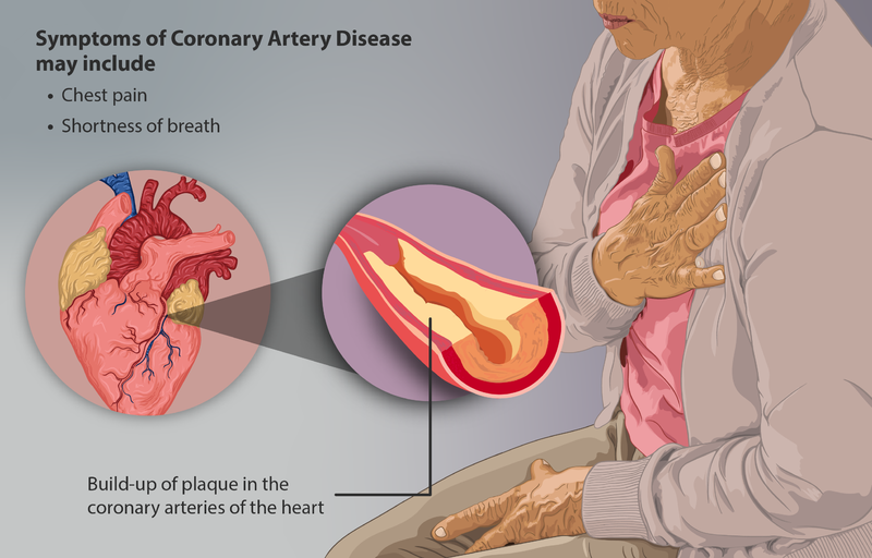 File:Coronary Artery Disease.png