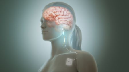 What Does HRV and the Vagus Nerve Have to Do With Anxiety? - Lief Blog