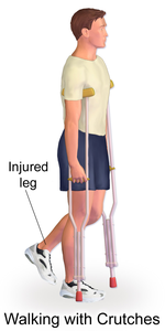 leg support crutches