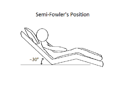 Semi-Fowler's-position.png