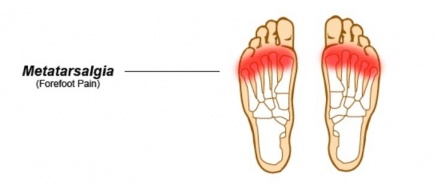 pain in front bottom of foot