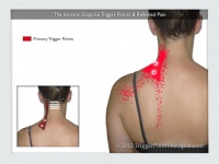 Levator scapula trigger points referred pain.jpg