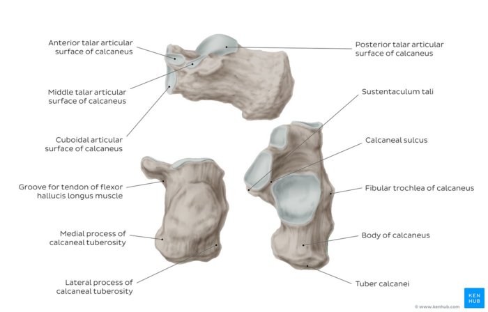 posterior calcaneal spur