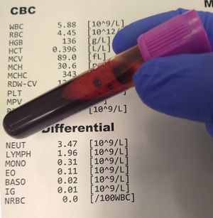 https://www.physio-pedia.com/images/thumb/6/6f/Blood_test.jpg/300px-Blood_test.jpg