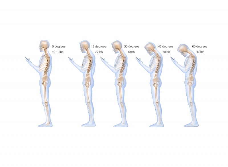 File:Texting and Mobile Usage Does to Your Spine.jpg