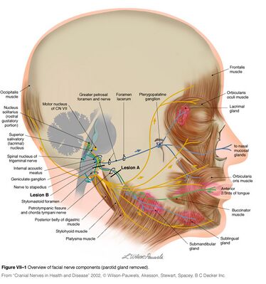 facial nerve palsy treatment