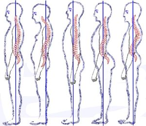Back Pain & Lumbo Pelvic Hip Girdle DVDs, Stretching
