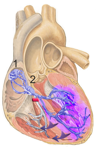 File:Heart; conduction system with right bundle branch block.png