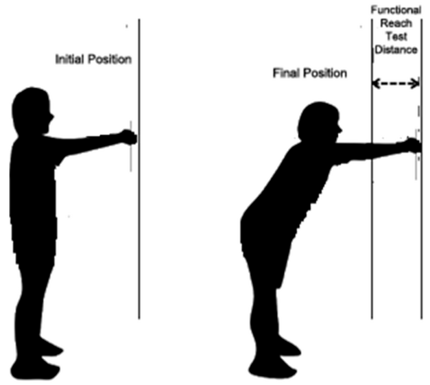 Functional Reach Test Frt Physiopedia 9786