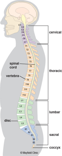 A brace to address functional 4-curve patterns for right thoracic and