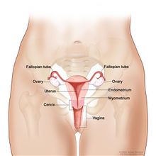 Ovarian cancer.jpg