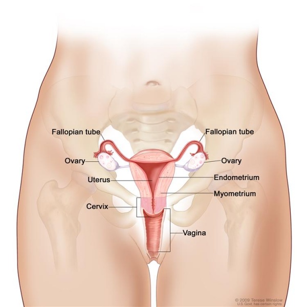 File:Ovarian cancer.jpg