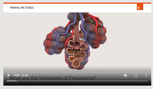 Symptoms of pneumonia.png