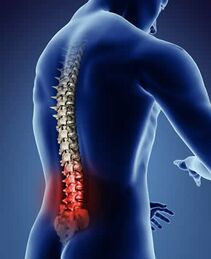 https://www.physio-pedia.com/images/thumb/9/9b/Lower-back-pain.jpg/211px-Lower-back-pain.jpg