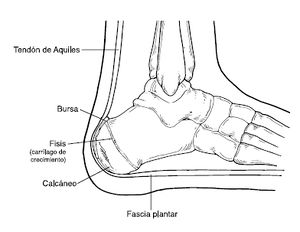 How to Prevent and Treat Heel Spurs: Optima Foot and Ankle