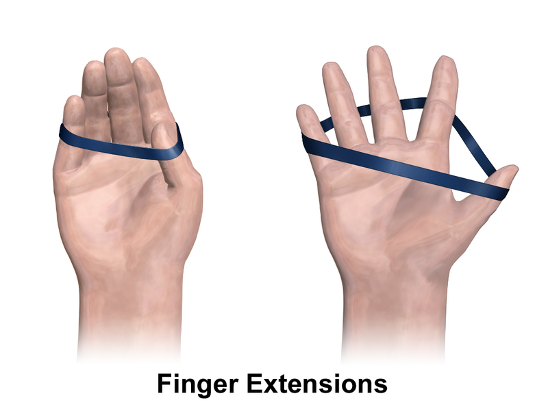 File:Finger extension exericse.png