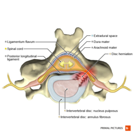 Lumbar Anatomy - Physiopedia