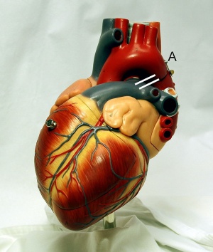 Heart model.jpg