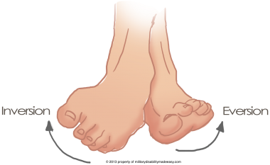 Two common types of ankle sprain (inversion and eversion) Stock