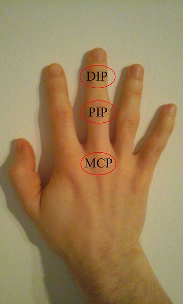 File:DIP, PIP and MCP joints of hand.jpg