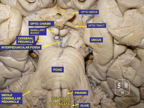 Pons 및 medulla oblongata2.jpg