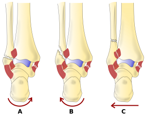 Image of right ankle (a) and left ankle (b) of the patient showing