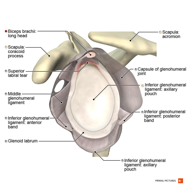 File:Illustration of SLAP II lesion.png