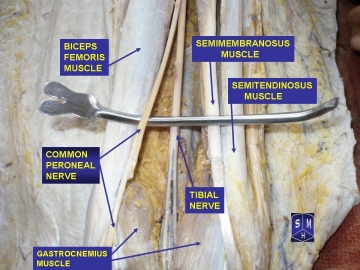 superficial peroneal nerve block