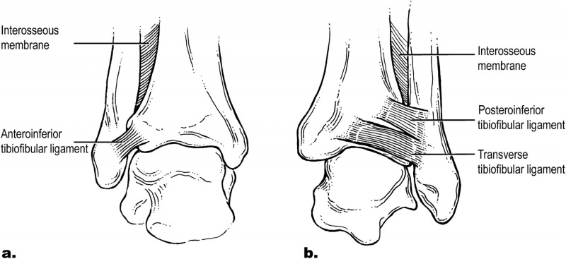 File:Syndesmosis ligaments.jpg