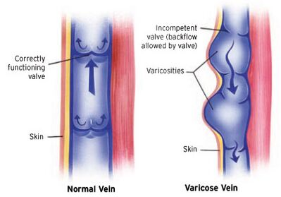 function of venous valves