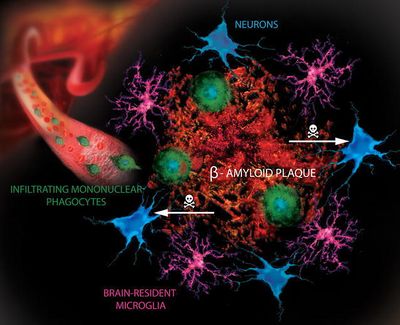 Mononuclear phagocytes in Alzheimer’s disease.jpg