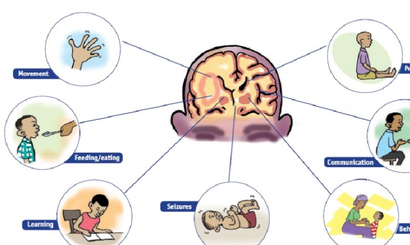 Cerebral Palsy Introduction - Physiopedia