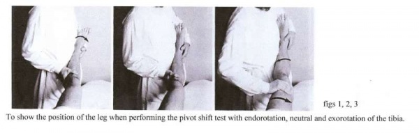 lateral pivot shift test knee