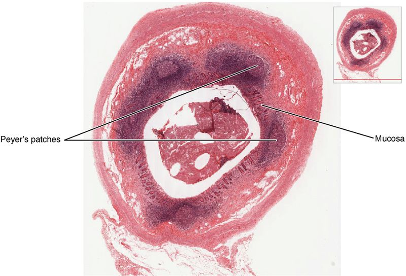 File:2210 Mucosa Associated Lymphoid Tissue (MALT) Nodule.jpg