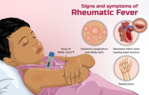 Rheumatic Fever.png