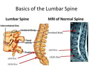 Back Pain & Lumbo Pelvic Hip Girdle DVDs, Stretching