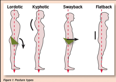 Free Vectors  upright posture spine sagittal male