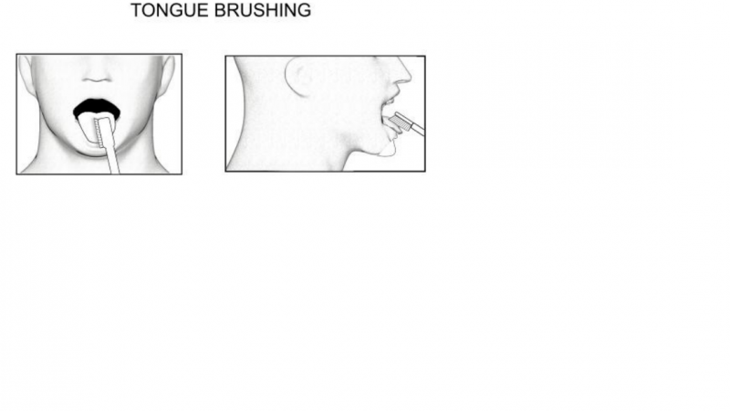 File:Tongue brushin Exercise1.png