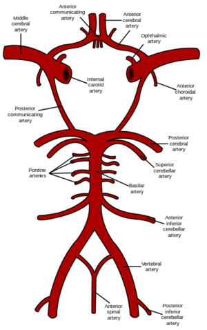 middle cerebral artery angiogram